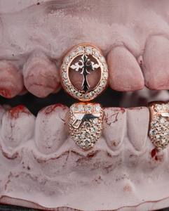 Grillz sur mesure de qualité supérieure, coupe ovale, en argent S925, plaqué or massif 10K 14K 18K, Moissanite VVS, sertis de pierres, pour les dents - Product Image 6