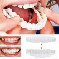 Prothèses dentaires populaires Snap Smile personnalisées pour un sourire parfait, couvre-dents supérieurs et inférieurs, protège-dents