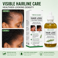 Huile de romarin et de ricin 100% naturelle, marque privée, traitement capillaire pour hommes et femmes, soin du cuir chevelu, sérum, huile de croissance capillaire, élixir