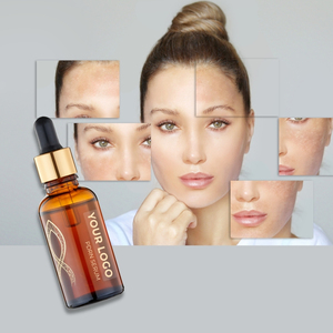 Wholesale Professional Mandelic Acid And PDRN Serum Skin Renewal Firming Essence For Combination Skin OEM ODM Factory - Product Image 1