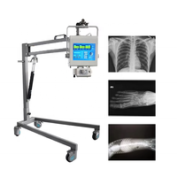 Machine mobile à rayons X Machine à rayons X médicale Diagnostic d'examen physique Équipement médical mobile Dr