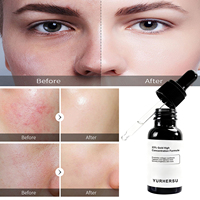 Sérum Vitamine C Marque Blanche Rétinol Acide Hyaluronique B5 Formule Haute Concentration Lisse la Peau Rugueuse Éclaircit Répare la Barrière Cutanée