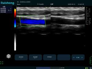DYX Hoogwaardige draagbare veterinaire echografie <span class=keywords><strong>Doppler</strong></span>-apparaat Prijs voor dieren - Product Image 6