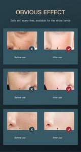 Tratamiento DE CUIDADO DE LA PIEL antienvejecimiento de siete colores Máquina facial de belleza Forma de escritorio plegable - Product Image 5