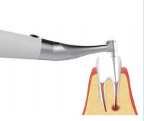High-efficiency Super silent Dental Endodontics Brushlesss Endo Motor