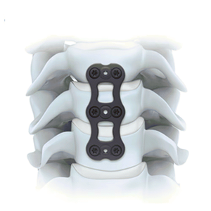 Kit de rétracteur cervical antérieur en acier inoxydable certifié CE ISO, ensemble d'instruments chirurgicaux ACDF pour la fixation de plaques - Product Image 4