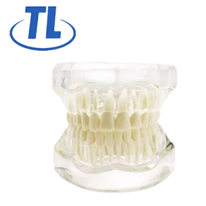 Hotseller NieuwBeijing TIANLIAN Transparant Anatomisch Tandmodel Prothese Implantaat Pathologisch Displaymodel - Product Image 1