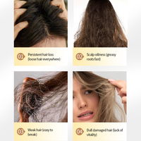 Serum Pertumbuhan Rambut Rosemary Peptide Anti Rambut Rontok, Perawatan Kulit Kepala yang Menutrisi dan Memperkuat, Serum Perbaikan