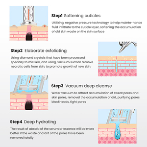 Nueva máquina facial <span class=keywords><strong>de</strong></span> microdermoabrasión 3 en 1 mejorada, rejuvenecimiento <span class=keywords><strong>de</strong></span> la piel, exfoliación limpiadora - Product Image 4