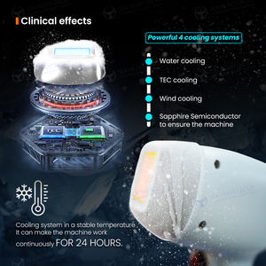 Máquina de Depilación Láser de Diodo Comercial Seaheart Medical CE <span class=keywords><strong>TEC</strong></span>, Enfriamiento con Hielo, Indolora, Titanio, Barra Osram Alemana, 808nm - Product Image 4