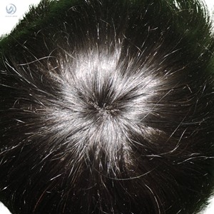 Mirage Border Premium Toupet pour hommes Indien Remy Cheveux Patch avec PU Technique Haute Qualité Cheveux Grade - Product Image 5