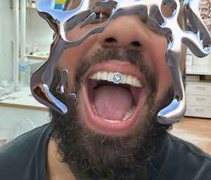 Hip Hop argent glacé Grillz haut bas Zircon cubique Moissanite diamant dents décoration 10k 14k 18k or 925 dents en argent - Product Image 2