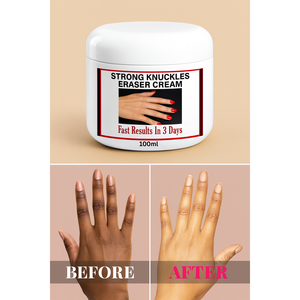 Crema Aclarante, Blanqueadora y Antienvejecimiento para Nudillos, Codos y Rodillas con Manteca de Karité y Hierbas de Acción Rápida 100ml - Product Image 1