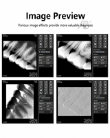 Sensor de Imagenología Dental Profesional para Clínicas Dentales, Sistema de Sensor de Imagen Nítida, Equipo para Dentistas, Sensor ECO