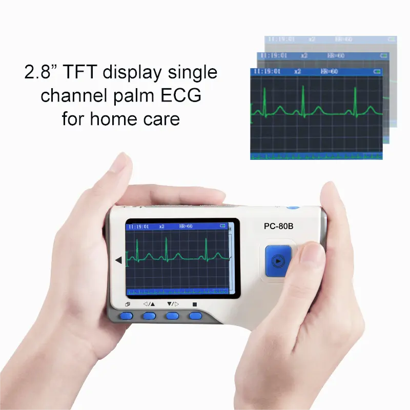 Hộ gia đình thiết bị y tế di động duy nhất kênh không dây dễ dàng ECG màn hình