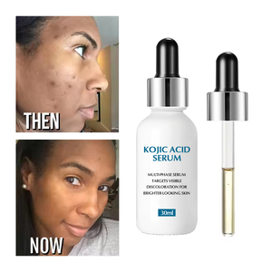 Suero de Ácido Kójico para el cuidado de la piel, crema blanqueadora facial coreana, eliminador de manchas oscuras, marca privada - Product Image 2