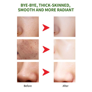 Gel Esfoliante all'Aloe Vera Idratante Nutriente Ammorbidente Rimozione Pelle Morta Viso e Corpo Tutti <span class=keywords><strong>i</strong></span> Tipi di Pelle Pelle Radiosa - Product Image 4