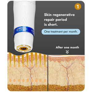 Synogal OEM ODM Multifunctionele Hoge Intensiteit Gefocusseerde Ultrasone Gezichtslift Anti-verouderings HIFU Beautyapparaat - Product Image 3