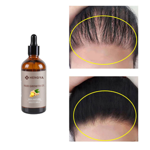 Bán Buôn Hữu Cơ Tăng Trưởng Tóc Thiết Lập Chống Rụng Tóc Rắn Tốt Nhất Tự Nhiên Vua Cũ Gừng Dầu Gội Đầu Và Điều Hòa Cho Sự Tăng Trưởng Tóc - Product Image 4