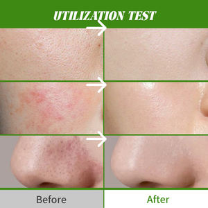 Maschera di <span class=keywords><strong>argilla</strong></span> <span class=keywords><strong>grigia</strong></span> per pulizia profonda diretta in fabbrica carbone di bambù e <span class=keywords><strong>argilla</strong></span> caolino per il viso disintossicare ed esfoliare per una pelle liscia e chiara - Product Image 2