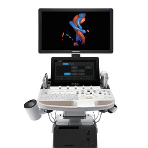 सोनोस्कैप पी 60 एक्सपी लागत प्रभावी पेशेवर अल्ट्रासाउंड मशीन - Product Image 1