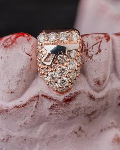 Grillz sur mesure de qualité supérieure, coupe ovale, en argent S925, plaqué or massif 10K 14K 18K, Moissanite VVS, sertis de pierres, pour les dents - Product Image 5