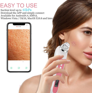 H200 ménage équipement de beauté aspirateur visage nettoyant points noirs élimination de l'acné machine dispositif vide visuel élimination des points noirs - Product Image 2