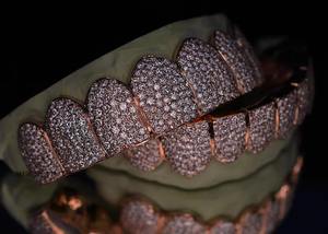 Custom <b>Rose</b> <b>Gold</b> Full Set Iced Out Diamond Grillz for <b>Top</b> and Bottom Teeth VVS1 Simulated Stones Hip Hop Mouthpiece Jewelry - Product Image 2