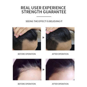 Kit de pigmento de maquillaje permanente para el cabello, cabeza de <span class=keywords><strong>micropigmentación</strong></span> del cuero cabelludo, juego de tinta de tatuaje, <span class=keywords><strong>micropigmentación</strong></span> del cuero cabelludo, microtatuaje - Product Image 2