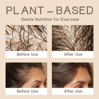 Formule OEM/ODM disponible pour la croissance des cheveux, soutien contre la chute des cheveux à base de biotine, action rapide, repousse des cheveux, nourrit le cuir chevelu