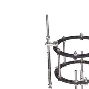 Fijador externo manual de acero para instrumentos quirúrgicos ortopédicos de alargamiento óseo de Pakistán - Product Image 6