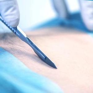 Mango de Bisturí Quirúrgico Veterinario Ortopédico Médico, Acero Inoxidable, Reutilizable, Herramienta de Instrumento de Cirugía General - Product Image 6