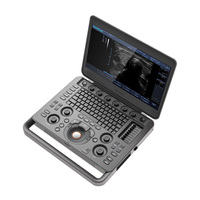 Sistema de Ultrasonido Doppler Color Veterinario Equino SonoScape X5V para Diagnóstico por Imágenes y Examen Reproductivo de Caballos