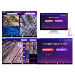 Factory Price Hair Scalp Analysis Equipment Machine With 15 Inch Lcd Skin Hair Scalp Analyzer <strong>Detector</strong> Made in China - Product Image 1