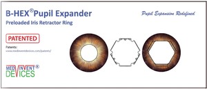 Juego de Expansores Pupiles B-OCTA 8.00 B-HEX, Perlas de Vidrio con Recubrimiento Antirreflectante, Plano-Convexo, Equipo Óptico Personalizable OEM - Product Image 4