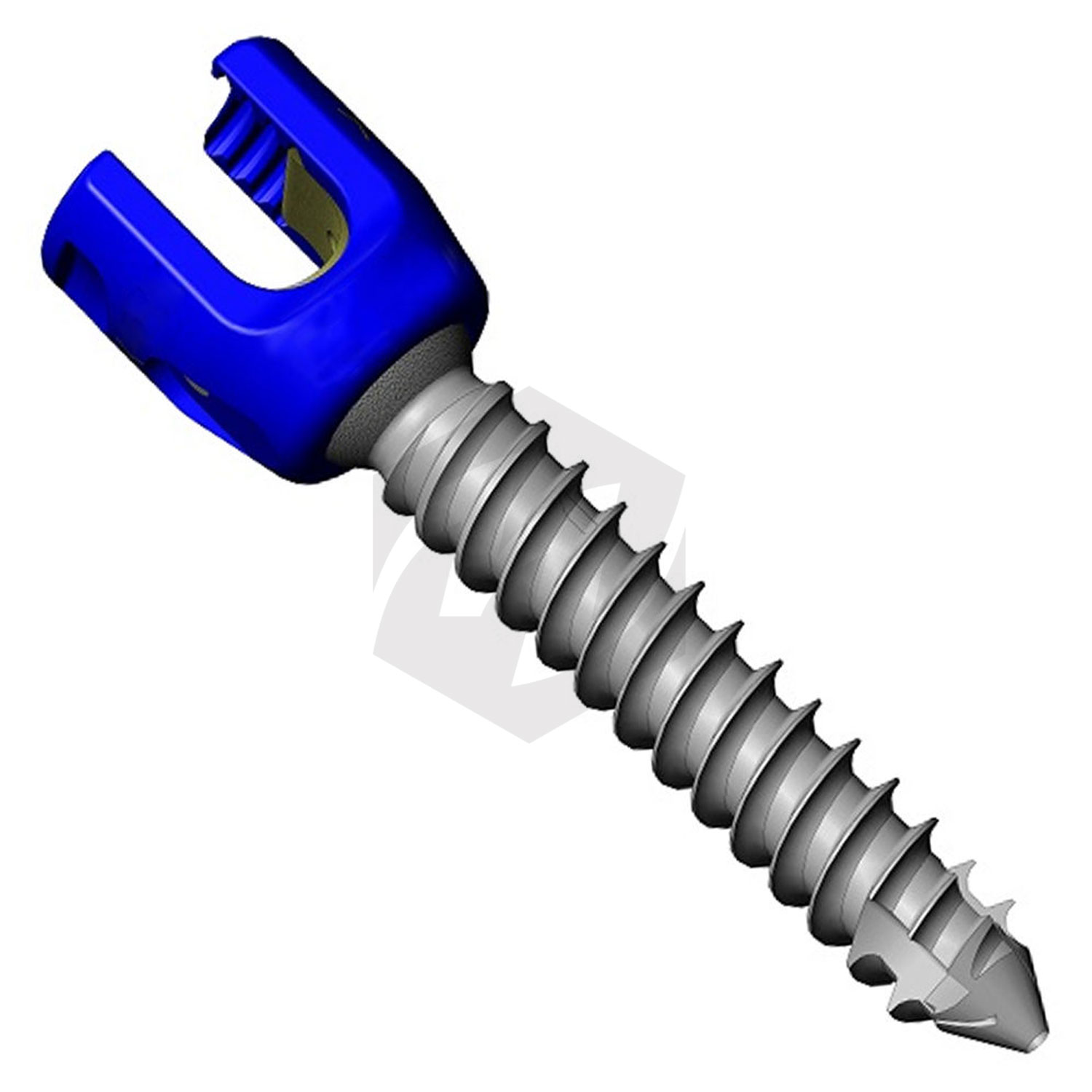 Implantes Ortopédicos