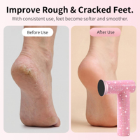 Ponceuse électrique 3-en-1 pour pieds, lime à callosités, outil de pédicure, 3 têtes interchangeables, 60W, rechargeable, pour usage domestique, finition diamant