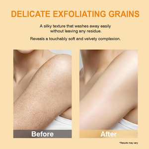 Fabricante OEM de Exfoliante Facial y Corporal con Ácido Kójico y Cúrcuma, Aclara la Pigmentación, Calmante, Antiinflamatorio y Exfoliante - Product Image 4