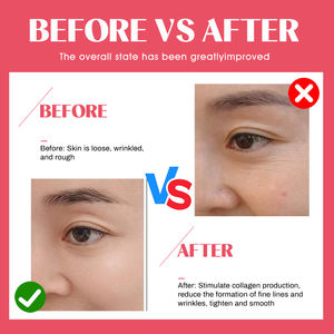 ชุดเอสเซนส์บำรุงผิวหน้า AQUA จากเกาหลี OEM - ไฮยาลูรอนและวิตามินซี ช่วยเติมความชุ่มชื้นและบำรุงผิวอย่างล้ำลึก - Product Image 5