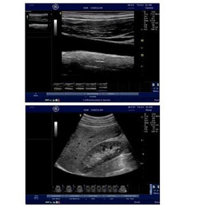 Appareil d'échographie GE Vivid e d'occasion - Product Image 2