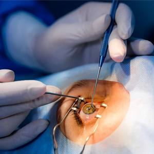 Kelly Descemet Membrance Punch 1mm X 0,75mm Longitud total 14cm Acero inoxidable Manual Instrumentos oftálmicos Medzora Quirúrgico - Product Image 4