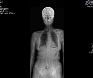 Tüm vücut için gelişmiş 17*48 inç <span class=keywords><strong>DR</strong></span> düz panel dedektör x-ray - Product Image 6