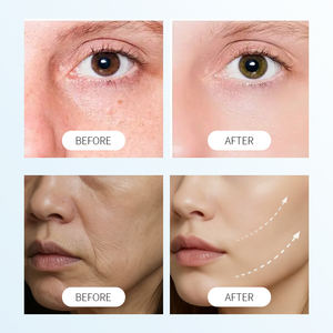 Suero de ácido hialurónico personalizado, vitamina B5, antienvejecimiento, hidratante, reparador de líneas finas, arrugas, seguro para pieles sensibles, cara dirigida - Product Image 6