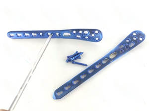 Lot de 155 pièces de vis de fixation médiale distale du tibia de 3,5 mm L+R - Product Image 4