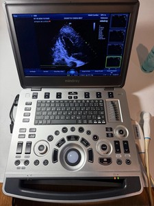 Sistema de Diagnóstico por Imágenes de Ultrasonido Portátil Premium, Escáner Médico para Cardiología y Radiología - Product Image 2