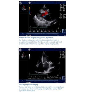 Appareil d'échographie GE Vivid e d'occasion - Product Image 4