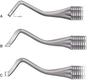 Recortador de márgenes, recortador de márgenes gingivales, preparación de márgenes de esmalte Mesial y Dental, escalador, Instrumentos dentales - Product Image 3