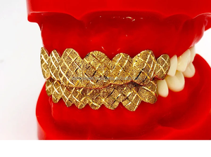 Bijoux fins Grilliz pour hommes et femmes Dents en or massif 10K 14K personnalisées Grillz Hip Hop Style Diamant Vvs - Product Image 3