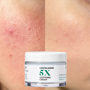 ครีมบำรุงผิวหน้าสูตรเซนเทลล่า กลีเซอรีน นิวแอลทูวีเอส 50 มล. ช่วยฟื้นฟูเกราะป้องกันผิว ลดรอยสิว บำรุงผิวขาวใส ให้ความชุ่มชื้นทุกวัน - Product Image 1