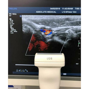 Transducteur/Sonde Linéaire Compacte Philips CX L12-5 Neuf - Product Image 3